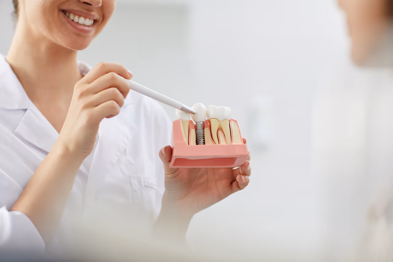 How Do I Prepare For Dental Implants?